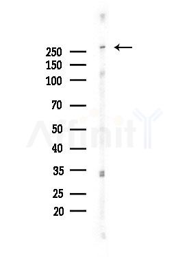 Phospho-Filamin A (Tyr1604) Antibody - Western blot analysis of lysates from COLO205 cells, using Phospho-Filamin A (Tyr1604) Antibody at 1/1000 dilution.
