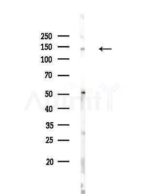 Phospho-HER3/ErbB3 (Tyr1222) Antibody - Western blot analysis of lysates from HUVEC cells, using Phospho-HER3/ErbB3 (Tyr1222) Antibody at 1/1000 dilution.