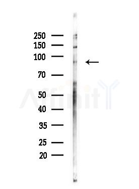 Phospho-FGFR4 (Tyr642) Antibody - Western blot analysis of lysates from COLO205 cells, using Phospho-FGFR4 (Tyr642) Antibody at 1/1000 dilution.