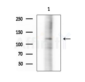 Phospho-CBL (Ser767) Antibody - Western blot analysis of extracts from various samples, using Phospho-CBL (Ser767) Antibody at 1/1000 dilution.