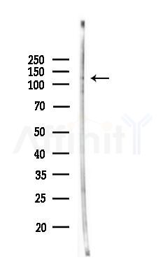 Phospho-CBL (Ser767) Antibody - Western blot analysis of lysates from 3T3-L1 P6(LPS, 4h treatment), using Phospho-CBL (Ser767) Antibody at 1/1000 dilution.