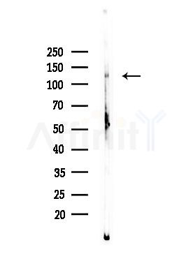 Phospho-JAK1 (Tyr1125) Antibody - Western blot analysis of lysates from EC304 cells, using Phospho-JAK1 (Tyr1125) Antibody at 1/1000 dilution.