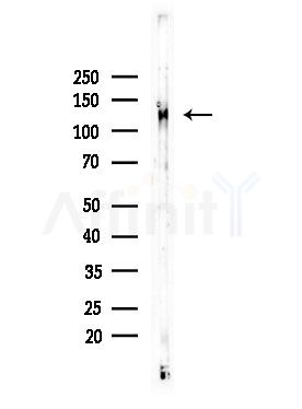Phospho-JAK1 (Tyr1125) Antibody - Western blot analysis of lysates from COLO205 cells, using Phospho-JAK1 (Tyr1125) Antibody at 1/1000 dilution.
