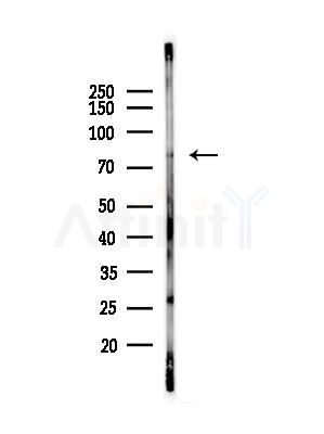 Phospho-eIF4B (Ser497) Antibody - Western blot analysis of lysates from B16F10-LUC cells(heat-shock,45min treatment), using Phospho-eIF4B (Ser497) Antibody at 1/1000 dilution.