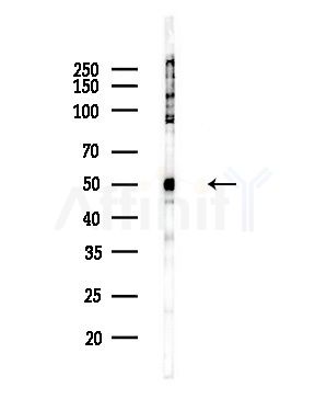 Phospho-GATA2 (Ser401) Antibody - Western blot analysis of lysates from COLO205 cells(UV,30min treatment), using Phospho-GATA2 (Ser401) Antibody at 1/1000 dilution.