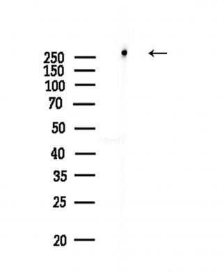 Phospho-Rpb1 CTD (Ser2/Ser5) Antibody - Western blot analysis of lysates from COLO205 cells(heat-shock,45min treatment), using Phospho-Rpb1 CTD (Ser2/Ser5) Antibody at 1/1000 dilution.