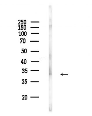 Phospho-CDK1/CDC2 (Tyr15) Antibody - Western blot analysis of lysates from COLO205 cells(heat-shock,45min treatment), using Phospho-CDK1/CDC2 (Tyr15) Antibody at 1/1000 dilution.
