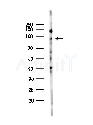 Phospho-MCM3 (Ser160) Antibody - Western blot analysis of lysates from HepG2 cells(starvation,24h treatment), using Phospho-MCM3 (Ser160) Antibody at 1/1000 dilution.