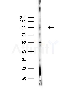 Phospho-EPHA2 (Tyr588) Antibody - Western blot analysis of lysates from HUVEC cells, using Phospho-EPHA2 (Tyr588) Antibody at 1/1000 dilution.