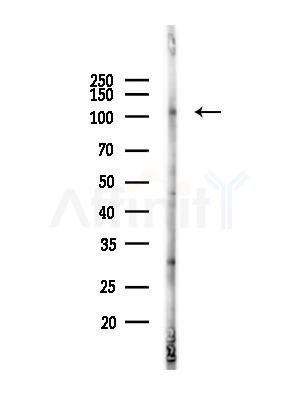 Phospho-EPHA2 (Tyr594) Antibody - Western blot analysis of lysates from EC304 cells(heat-shock,45min treatment), using Phospho-EPHA2 (Tyr594) Antibody at 1/1000 dilution.