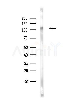 Phospho-EPHA2 (Tyr772) Antibody - Western blot analysis of lysates from HUVEC cells, using Phospho-EPHA2 (Tyr772) Antibody at 1/1000 dilution.