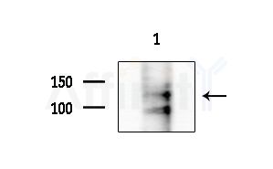 Phospho-EPHA3 (Tyr596) Antibody - Western blot analysis of extracts from COLO205 cells, using Phospho-EPHA3 (Tyr596) Antibody at 1/1000 dilution.
