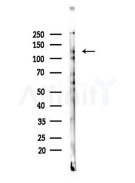 Phospho-EPHA3 (Tyr596) Antibody - Western blot analysis of lysates from COLO205 cells, using Phospho-EPHA3 (Tyr596) Antibody at 1/1000 dilution.