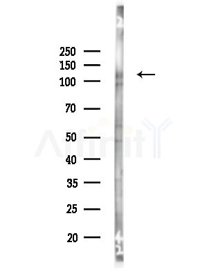 Phospho-EPHA3 (Tyr779) Antibody - Western blot analysis of lysates from HUVEC cells, using Phospho-EPHA3 (Tyr779) Antibody at 1/1000 dilution.