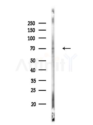 Phospho-SHP1 (Ser534) Antibody - Western blot analysis of lysates from HUVEC cells, using Phospho-SHP1 (Ser534) Antibody at 1/1000 dilution.
