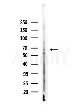 Phospho-NF2 / Merlin (Ser13) Antibody - Western blot analysis of lysates from EC304 cells, using Phospho-NF2 / Merlin (Ser13) Antibody at 1/1000 dilution.