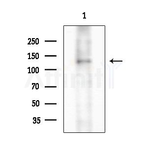 Phospho-SREBP1 (Ser338) Antibody - Western blot analysis of extracts from 293 cells(starvation treatment), using Phospho-SREBP1 (Ser338) Antibody at 1/1000 dilution.