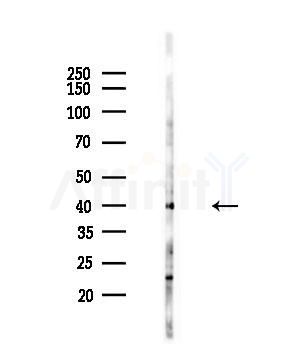 Phospho-CrkL (Tyr251) Antibody - Western blot analysis of lysates from 293 cells(starvation,24h treatment), using Phospho-CrkL (Tyr251) Antibody at 1/1000 dilution.