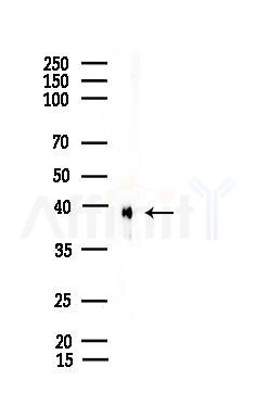 Phospho-CrkL (Tyr198) Antibody - Western blot analysis of lysates from EC304 cells, using Phospho-CrkL (Tyr198) Antibody at 1/1000 dilution.