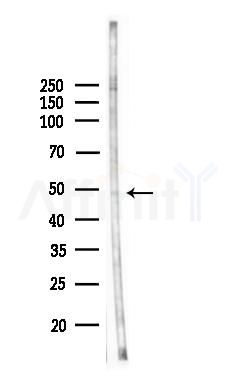 Phospho-ARRB1 (Tyr173) Antibody - Western blot analysis of lysates from 3T3-L1 P6(LPS, 4h treatment), using Phospho-ARRB1 (Tyr173) Antibody at 1/1000 dilution.