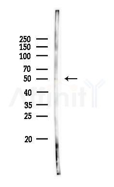 Phospho-ARRB1 (Tyr173) Antibody - Western blot analysis of lysates from Rat lung, using Phospho-ARRB1 (Tyr173) Antibody at 1/1000 dilution.