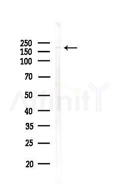 Phospho-Tuberin/TSC2 (Thr938) Antibody - Western blot analysis of lysates from 3T3-L1 P6(LPS, 4h treatment), using Phospho-Tuberin/TSC2 (Thr938) Antibody at 1/1000 dilution.
