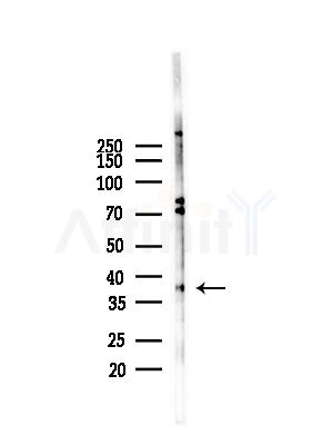 Phospho-CDK7 (Ser164) Antibody - Western blot analysis of lysates from Hela cells(heat-shock, 45min treatment), using Phospho-CDK7 (Ser164) Antibody at 1/1000 dilution.
