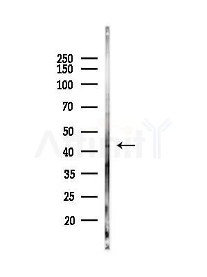 Phospho-CDK9 (Ser347) Antibody - Western blot analysis of lysates from B16F10-LUC cells(heat-shock,45min treatment), using Phospho-CDK9 (Ser347) Antibody at 1/1000 dilution.