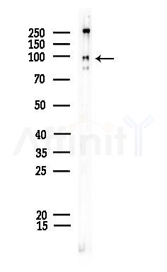 Phospho-RSK2 (Thr577) Antibody - Western blot analysis of lysates from COLO205 cells, using Phospho-RSK2 (Thr577) Antibody at 1/1000 dilution.