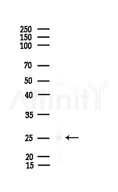 Phospho-Rac1/cdc42 (Tyr64) Antibody - Western blot analysis of lysates from EC304 cells, using Phospho-Rac1/cdc42 (Tyr64) Antibody at 1/1000 dilution.