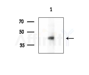 Phospho-YB1 (Ser176) Antibody - Western blot analysis of extracts from EC304 cells(heat-shock treatment), using Phospho-YB1 (Ser176) Antibody at 1/1000 dilution.