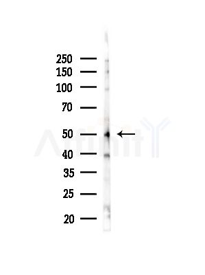 Phospho-YB1 (Ser176) Antibody - Western blot analysis of lysates from EC304 cells(heat-shock,45min treatment), using Phospho-YB1 (Ser176) Antibody at 1/1000 dilution.