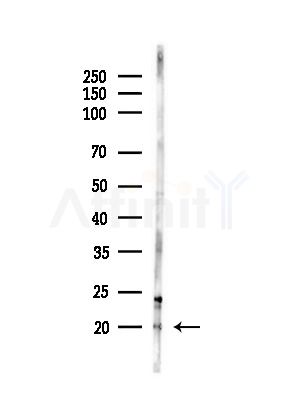 Phospho-Histone H3 (Thr81) Antibody - Western blot analysis of lysates from Hela cells(heat-shock,45min treatment), using Phospho-Histone H3 (Thr81) Antibody at 1/1000 dilution.