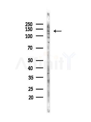 Phospho-PLCB3 (Ser1105) Antibody - Western blot analysis of lysates from COLO205 cells(UV,30min treatment), using Phospho-PLCB3 (Ser1105) Antibody at 1/1000 dilution.