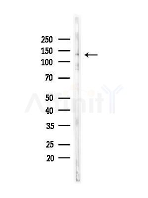 Phospho-PLCB3 (Ser1105) Antibody - Western blot analysis of lysates from Mouse testis, using Phospho-PLCB3 (Ser1105) Antibody at 1/1000 dilution.