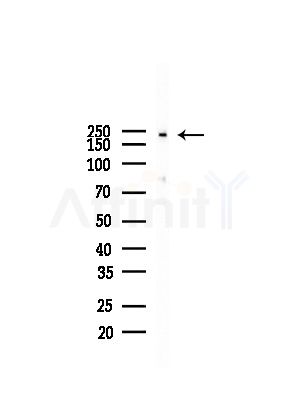 Phospho-eIF4G1 (Ser1147) Antibody - Western blot analysis of lysates from Hela cells(heat-shock, 45min treatment), using Phospho-eIF4G1 (Ser1147) Antibody at 1/1000 dilution.