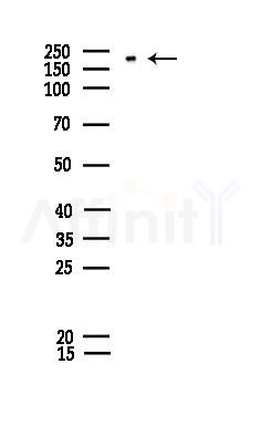 Phospho-eIF4G1 (Ser1185) Antibody - Western blot analysis of lysates from COLO205 cells, using Phospho-eIF4G1 (Ser1185) Antibody at 1/1000 dilution.