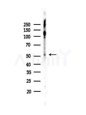 Phospho-MEF2C (Ser459) Antibody - Western blot analysis of lysates from EC304 cells(heat-shock,45min treatment), using Phospho-MEF2C (Ser459) Antibody at 1/1000 dilution.