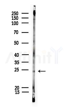 Phospho-Peroxiredoxin 1 (Ser196) Antibody - Western blot analysis of lysates from COLO205 cells, using Phospho-Peroxiredoxin 1 (Ser196) Antibody at 1/1000 dilution.