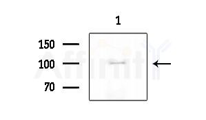 Phospho-ACK1 (Tyr284) Antibody - Western blot analysis of extracts from COLO205 cells, using Phospho-ACK1 (Tyr284) Antibody at 1/1000 dilution.