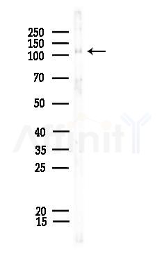 Phospho-ACK1 (Tyr284) Antibody - Western blot analysis of lysates from COLO205 cells, using Phospho-ACK1 (Tyr284) Antibody at 1/1000 dilution.