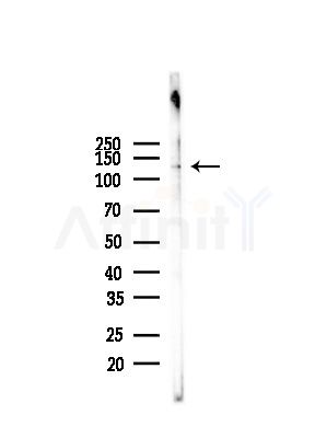 Phospho-FOXM1 (Thr600) Antibody - Western blot analysis of lysates from Hela cells(heat-shock, 45min treatment), using Phospho-FOXM1 (Thr600) Antibody at 1/1000 dilution.