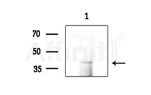 Phospho-TDP43 (Ser409) Antibody - Western blot analysis of extracts from COLO205 cells, using Phospho-TDP43 (Ser409) Antibody at 1/1000 dilution.