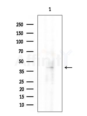 Phospho-TDP43 (Ser409) Antibody - Western blot analysis of extracts from EC304 cells, using Phospho-TDP43 (Ser409) Antibody at 1/1000 dilution.