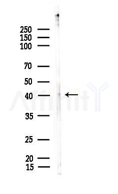 Phospho-TDP43 (Ser409) Antibody - Western blot analysis of lysates from EC304 cells, using Phospho-TDP43 (Ser409) Antibody at 1/1000 dilution.