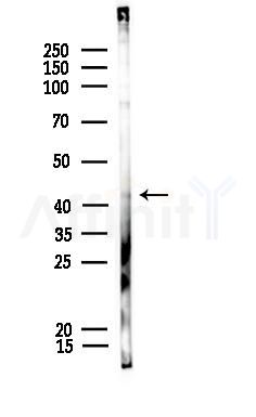 Phospho-TDP43 (Ser409) Antibody - Western blot analysis of lysates from COLO205 cells, using Phospho-TDP43 (Ser409) Antibody at 1/1000 dilution.