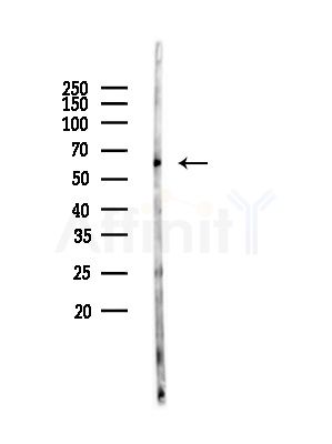 Phospho-SQSTM1/p62 (Ser366) Antibody - Western blot analysis of lysates from EC304 cells(starvation,24h treatment), using Phospho-SQSTM1/p62 (Ser366) Antibody at 1/1000 dilution.