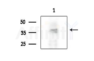 Phospho-CaMKII (Ser235) Antibody - Western blot analysis of extracts from COLO205 cells, using Phospho-CaMKII (Ser235) Antibody at 1/1000 dilution.