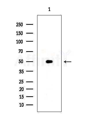 Phospho-CaMKII (Ser235) Antibody - Western blot analysis of extracts from Mouse lung, using Phospho-CaMKII (Ser235) Antibody at 1/1000 dilution.