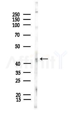Phospho-CaMKII (Ser235) Antibody - Western blot analysis of lysates from COLO205 cells, using Phospho-CaMKII (Ser235) Antibody at 1/1000 dilution.